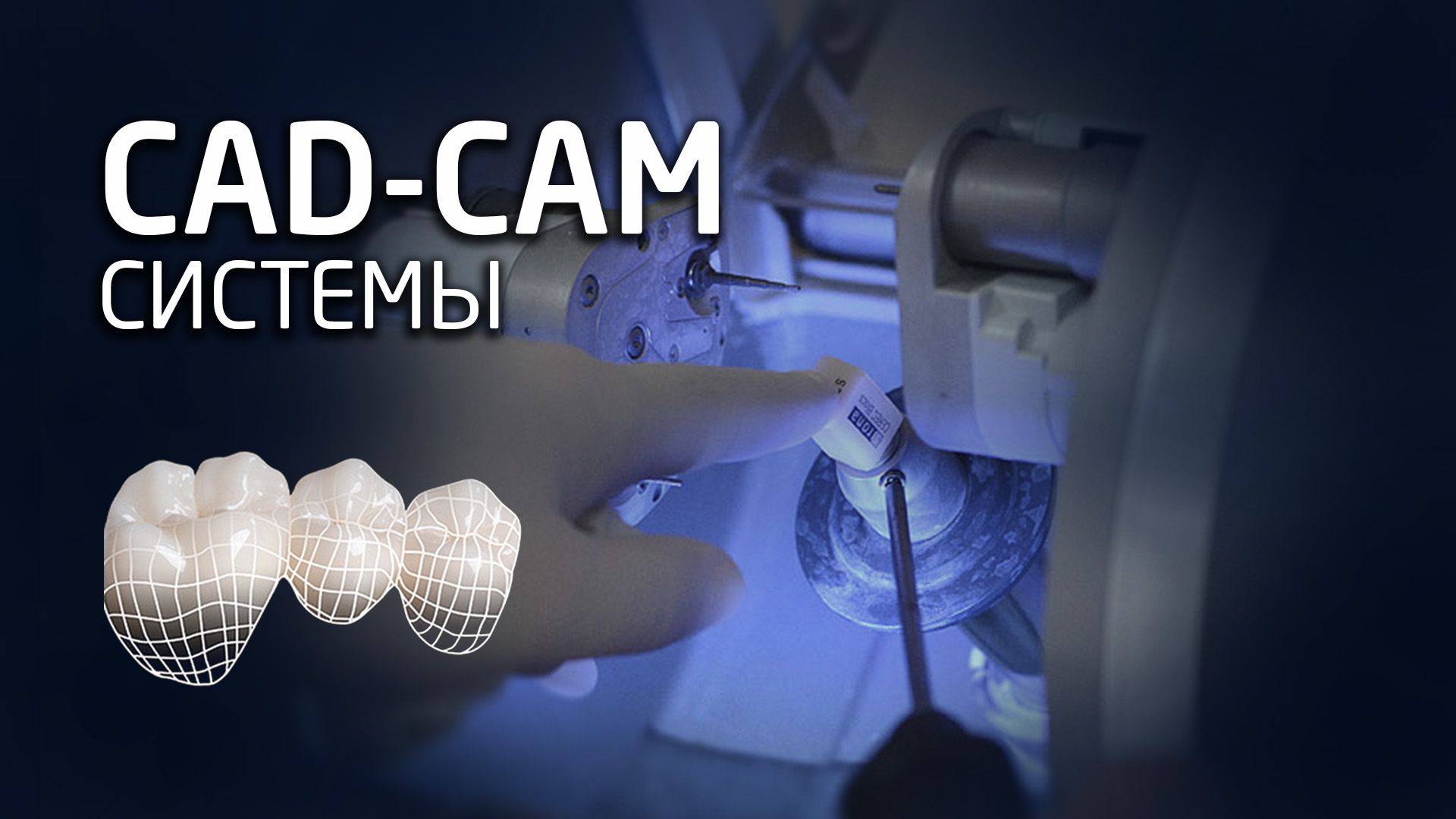 cad-cam-dentistry