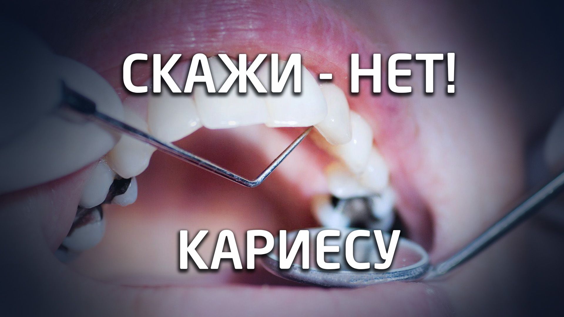 cavity-treatment