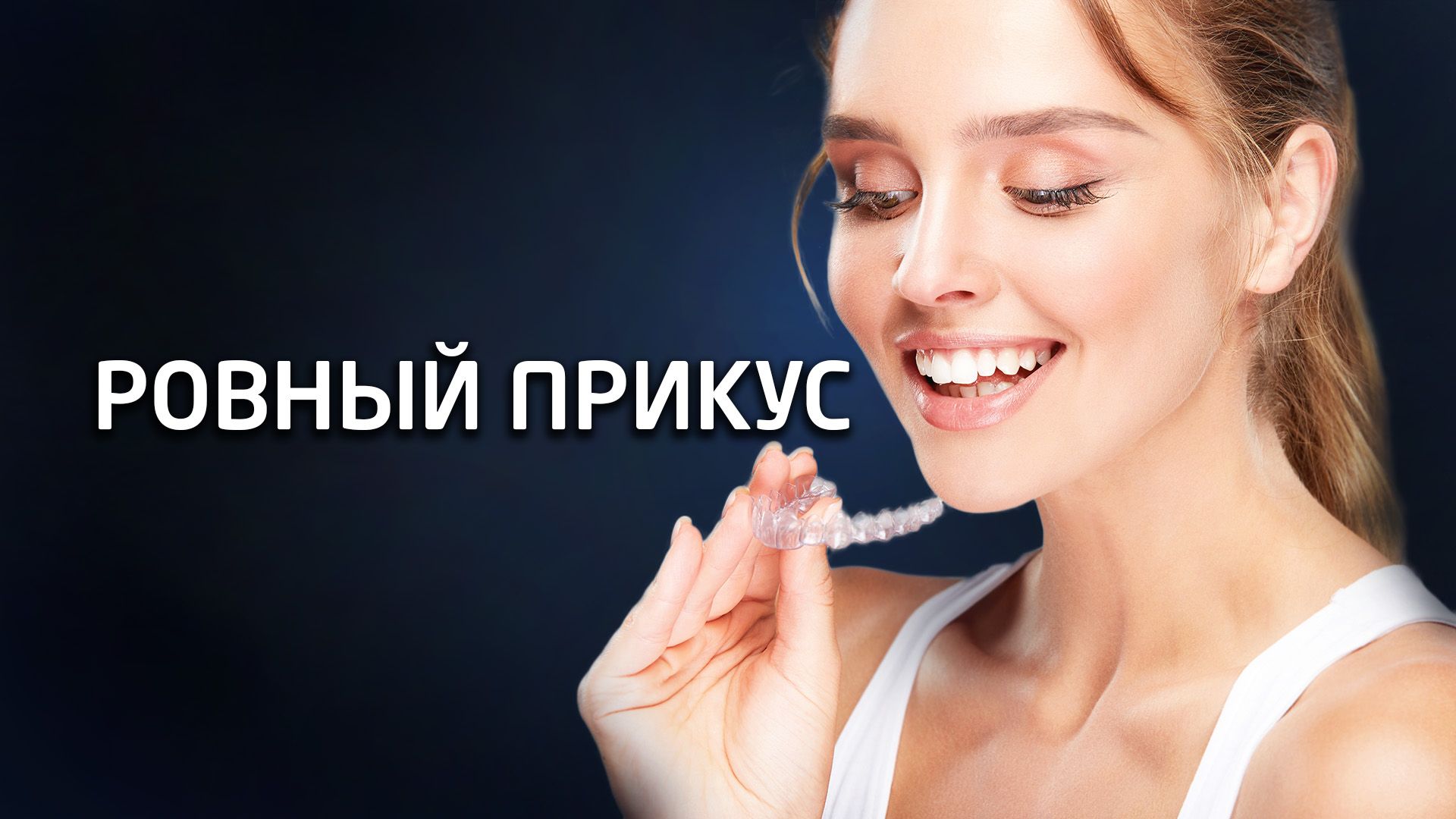 clear-aligners1